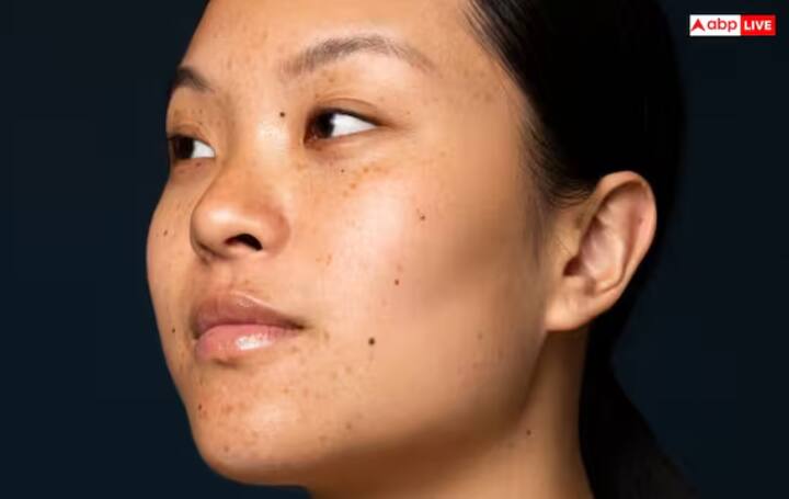 ਮੁਹਾਸਿਆਂ ਅਤੇ ਦਾਗ-ਧੱਬੇ ਕਰੇ ਦੂਰ - ਨਿੰਮ ਦਾ ਪਾਣੀ ਚਮੜੀ ਦੀ ਮੁਰੰਮਤ ਕਰਦਾ ਅਤੇ ਪੁਰਾਣੇ ਦਾਗ-ਧੱਬਿਆਂ ਨੂੰ ਹਲਕਾ ਕਰਦਾ ਹੈ।