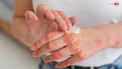 रोजाना नीम के पानी नहाने से दूर होती हैं स्किन की ये समस्याएं, ऐसे करें इस्तेमाल