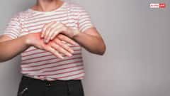 Health Tips: લોહીમાં વધતા યુરિક એસિડને કંટ્રોલ કરશે આ વસ્તુઓ, સાંધાના દુખાવામાં પણ મળશે રાહત