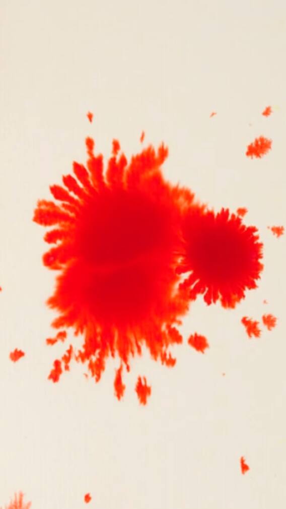 World Haemophilia Day 2025 — 10 Foods For Hemophilia Management