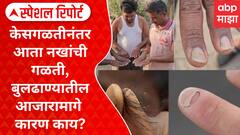Special Report On Buldhana : केसगळतीनंतर आता नखांची गळती, बुलढाण्यातील आजारामागे कारण काय?