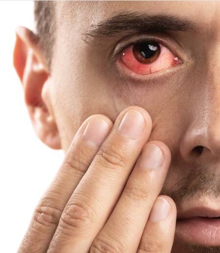 ਗਰਮੀ ਅਤੇ ਹੇਠਲੀ ਨਮੀ ਕਾਰਨ ਅੱਖਾਂ ਦੇ ਕੁਦਰਤੀ ਹੰਝੂਆਂ ਦੀ ਮਾਤਰਾ ਘੱਟ ਸਕਦੀ ਹੈ। ਇਸ ਨਾਲ ਅੱਖਾਂ ਵਿੱਚ ਸੁੱਕਾਪਣ, ਖੁਜਲੀ, ਅਤੇ ਲਾਲੀ ਹੋ ਸਕਦੀ ਹੈ। ਇਹ ਹਾਲਤ ਡਰਾਈ ਆਈ ਸਿੰਡਰੋਮ ਦੇ ਲੱਛਣਾਂ ਨੂੰ ਹੋਰ ਵੀ ਵਧਾ ਸਕਦੀ ਹੈ।