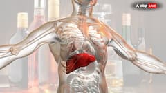 Fatty Liver To Cancer: 5 Deadly Outcomes Of Alcohol