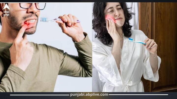 ਦੰਦਾਂ ’ਚੋਂ ਬ੍ਰੱਸ਼ ਕਰਦੇ ਸਮੇਂ ਖੂਨ ਆਉਣਾ ਇਕ ਆਮ ਪਰ ਗੰਭੀਰ ਲੱਛਣ ਹੋ ਸਕਦਾ ਹੈ ਜਿਸ ਨੂੰ ਅਕਸਰ ਲੋਕ ਅਣਦੇਖਾ ਕਰ ਦੇਂਦੇ ਹਨ। ਇਹ ਸਿਰਫ਼ ਸਧਾਰਣ ਬ੍ਰੱਸ਼ ਕਰਨ ਦੇ ਢੰਗ ਦੀ ਗਲਤੀ ਨਹੀਂ, ਸਗੋਂ ਮੂੰਹ ਦੀ ਸਿਹਤ ਨਾਲ ਜੁੜੀਆਂ ਗੰਭੀਰ ਸਮੱਸਿਆਵਾਂ..