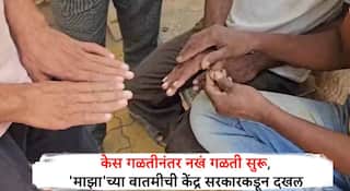 माझा इम्पॅक्ट : बुलढाणा जिल्ह्यातील केस गळती झालेल्या रुग्णांच्या नखं गळती प्रकरण; केंद्र सरकारकडून दखल, उच्च स्तरीय अधिकाऱ्यांच्या पथकाची नेमणूक