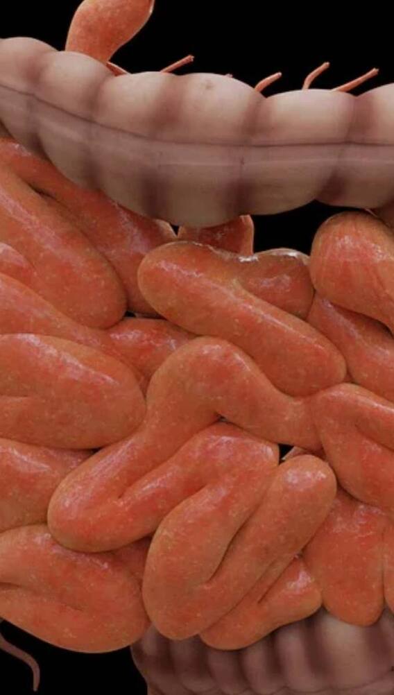 क्या वाकई सड़ सकती हैं इंसान की आंतें?