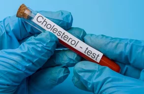 જો તમે પણ લાંબા સમય સુધી બેસો છો અને કોઈ શારીરિક પ્રવૃત્તિ નથી કરતા તો તેનાથી શરીરમાં બેડ કોલેસ્ટ્રોલ વધી શકે છે. નિયમિત કસરત કરવાથી ગુડ કોલેસ્ટ્રોલનું પ્રમાણ વધે છે, પરંતુ મોટાભાગના લોકો આળસને કારણે કસરત કરતા નથી.