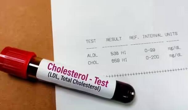 ફાસ્ટ ફૂડ, તળેલો ખોરાક અથવા પ્રોસેસ્ડ ફૂડમાં ટ્રાન્સ ચરબી અને સંતૃપ્ત ચરબીનું પ્રમાણ વધુ હોય છે. જો તમે પિઝા, બર્ગર, ફ્રાઈસ અથવા બ્રેડમાંથી બનેલી વસ્તુઓનું સેવન કરો છો, તો તેનાથી LDLનું સ્તર વધે છે. લોકો જાણે છે કે ફળો, શાકભાજી, આખા અનાજ ખાવા સ્વાસ્થ્ય માટે ફાયદાકારક છે, પરંતુ તેમ છતાં તેઓ તેમના ડાયટમાં જંક ફૂડ અને તળેલા ખોરાકનો સમાવેશ કરે છે.