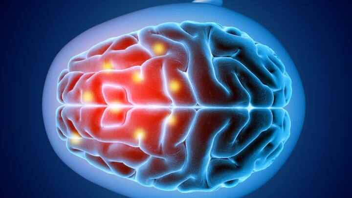 এই আবিষ্কার বৈজ্ঞানিক পরীক্ষা নিরীক্ষার জন্য অত্যন্ত গুরুত্বপূর্ণ হয়ে উঠেছে। কারণ ভিস্যুয়াল ইনফরমেশন মস্তিষ্ক কী ভাবে গ্রহণ করে, তা যে নির্দিষ্ট সংজ্ঞার মধ্যে আটকে নেই,  তা বোঝা গেল এই গবেষণা থেকে।