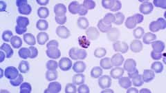 World Malaria Day 2025 — 7 Facts About Malaria That You Should Know