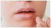 Lips Drying Reason: పదే పదే పెదాలు పొడిబారుతుంటే లైట్ తీసుకోవద్దు? అది ప్రాణాంతకం కావచ్చు!
