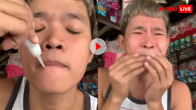 Man applied Feviquick on his lips and then what happened will shock you video goes viral Viral Video : క్యూరియాసిటీతో పెదవలకు పెవిక్విక్ రాసుకున్నాడు - ఆ తరవాతే అసలు కథ - జాలి కూడా చూపలేం ! వీడియో