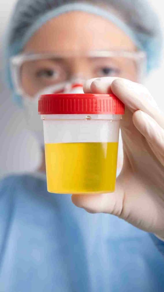 खुद की पेशाब क्यों पीते हैं लोग