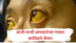 आजी-माजी आमदारांच्या राजूर गावात काविळचे थैमान, 22 वर्षांच्या युवतीचा मृत्यू