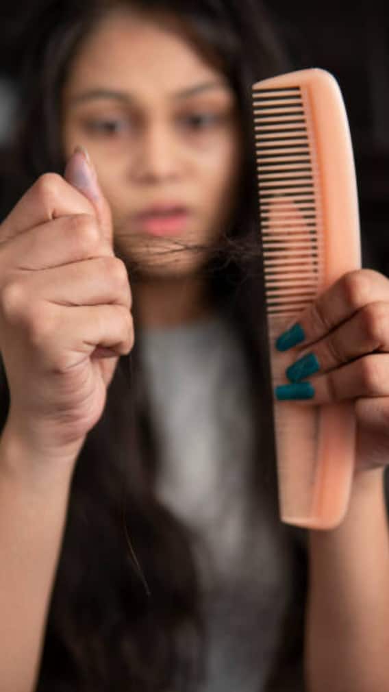 वक्त से पहले गंजे हो जाते हैं ये लोग