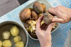 क्या आप भी कचरा समझकर फेंक देते हैं आलू के छिलके, फायदे जान लेंगे तो कभी नहीं करेंगे ये गलती