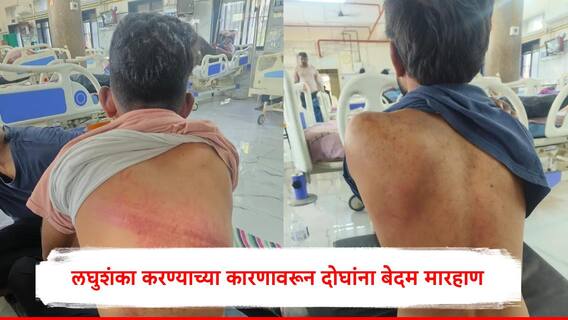Crime News : लघुशंका करण्याच्या कारणावरून दोघांना बेदम मारहाण, अहिल्यानगरमधील घटना, जखमींवर उपचार सुरु