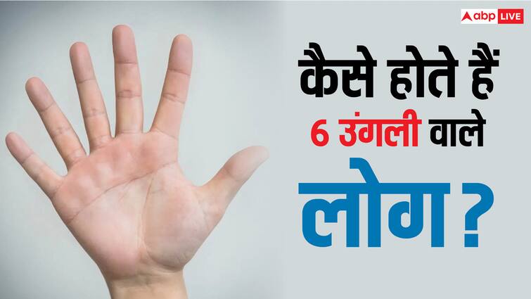 Person with six finger lucky intelligent hath me 6 ungaliyan hone ka matlab क्या वाकई में विशेष होते हैं जिनके हाथ में होती हैं 6 अंगुलिया?