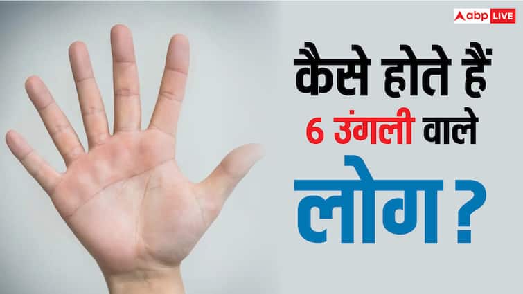 क्या वाकई में विशेष होते हैं जिनके हाथ में होती हैं 6 अंगुलिया? Person with six finger lucky intelligent hath me 6 ungaliyan hone ka matlab क्या वाकई में विशेष होते हैं जिनके हाथ में होती हैं 6 अंगुलिया?