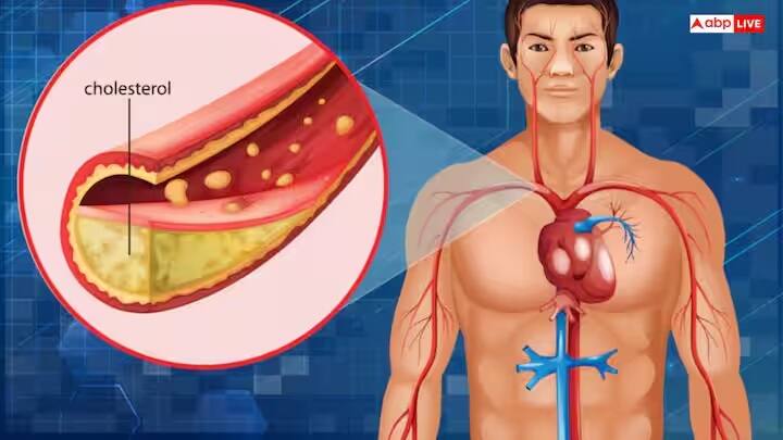 કોલેસ્ટ્રોલને નિયંત્રિત કરો - દૂધમાં જાયફળ ભેળવીને પીવાથી કોલેસ્ટ્રોલને ઘણી હદ સુધી નિયંત્રિત કરી શકાય છે. આનાથી હૃદયના સ્વાસ્થ્યમાં પણ સુધારો થઈ શકે છે.