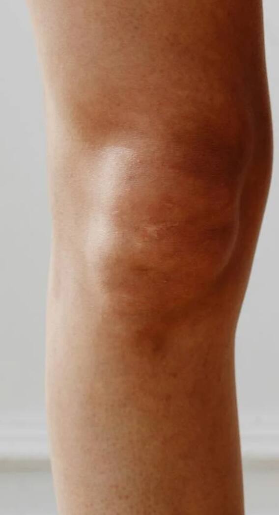 कैसे काम करते हैं इंसानों के घुटने?