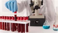 పీరియడ్స్ సమయంలో థైరాయిడ్ టెస్ట్ చేయించుకోవచ్చా? ఆ సమయంలో ఏ రక్త పరీక్షలు చేయించుకోకూడదంటే