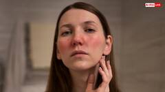 इन चीजों की वजह से होती है सबसे ज्यादा पिगमेंटेशन, ऐसे कर सकते हैं बचाव 