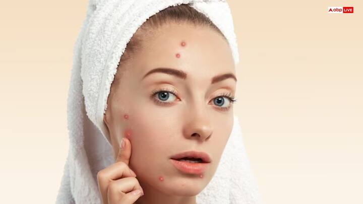 मुंहासों और दानों से राहत - गुलाबजल में एंटी-बैक्टीरियल और एंटी-इंफ्लेमेटरी गुण होते हैं, जो पिंपल्स, दानों और स्किन इरिटेशन को कम करने में मदद करते हैं.