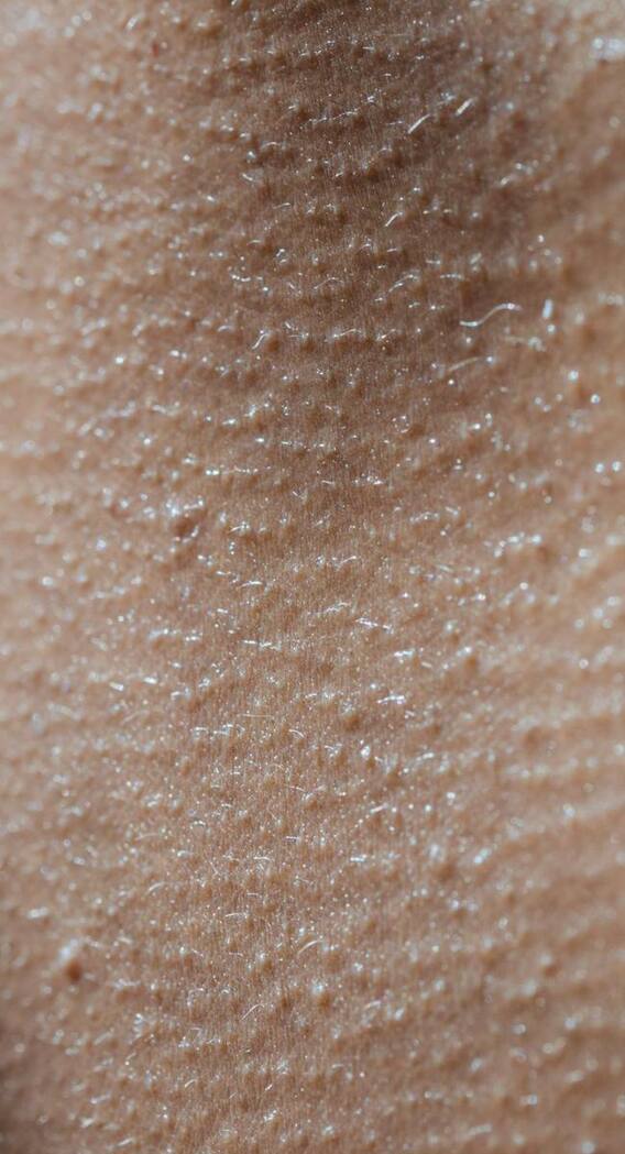 क्या इंसानों के अलावा जानवरों के भी होते हैं रौंगटे खड़े?