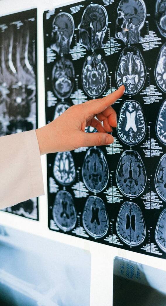 ब्रेन में स्ट्रोक से पहले दिखते हैं ये संकेत