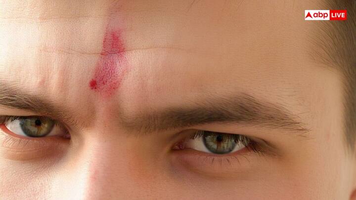 हिंदू धर्म में तिलक लगाने का विशेष महत्व है, जिससे व्यक्ति के जीवन में सकारात्मकता बढ़ती है और ग्रहों के नकारात्मक प्रभाव कम होते हैं. आमतौर पर शुभ अवसरों पर लाल तिलक लगाया जाता है, लेकिन कुछ राशि के लोगों के लिए लाल तिलक लगाना अशुभ हो सकता है. इसलिए, उन्हें इससे बचना चाहिए.