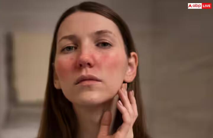 ਚਮੜੀ ਲਈ ਫਾਇਦੇਮੰਦ - ਸ਼ਹਿਤੂਤ ਦੇ ਪੱਤੇ ਸਰੀਰ ਨੂੰ ਅੰਦਰੋਂ ਡੀਟੌਕਸ ਕਰਦੇ ਹਨ, ਜਿਸ ਨਾਲ ਚਿਹਰੇ 'ਤੇ ਮੁਹਾਸੇ, ਸ਼ਾਈਆਂ ਅਤੇ ਦਾਗ-ਧੱਬੇ ਘੱਟ ਹੁੰਦੇ ਹਨ। ਇਹ ਗਰਮੀਆਂ ਵਿੱਚ ਚਮੜੀ ਦੀ ਐਲਰਜੀ ਤੋਂ ਬਚਣ ਦਾ ਇੱਕ ਕੁਦਰਤੀ ਉਪਾਅ ਹੈ।