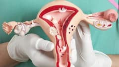 सिर्फ महिलाओं को ही होती हैं ये बीमारियां, 99 पर्सेंट पुरुष जानते ही नहीं इन दिक्कतों के नाम