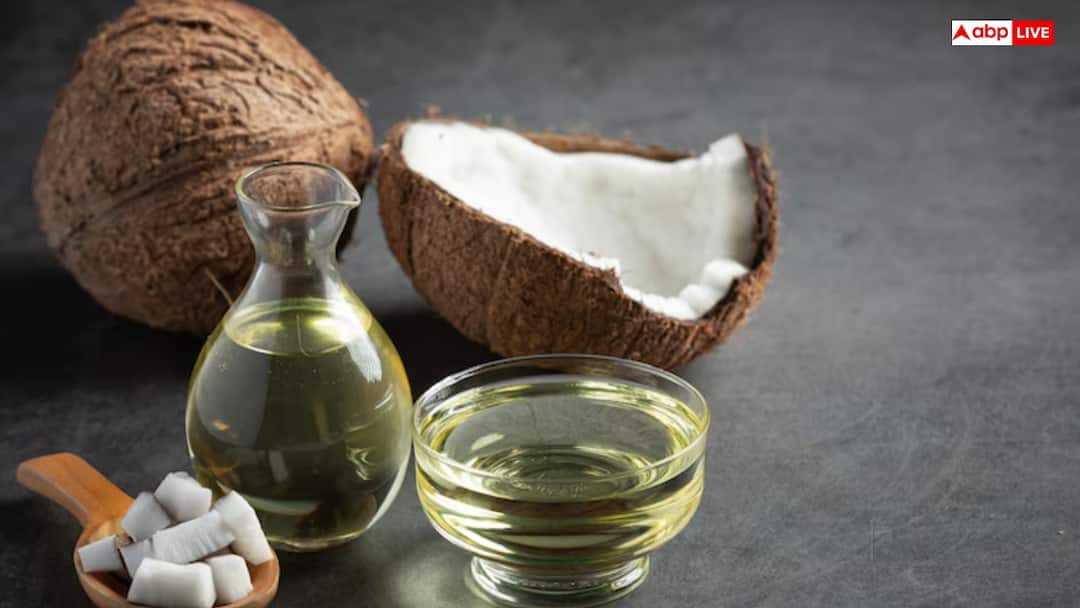 पतले बालों से छुटकारा दिलाएगा नारियल तेल, बस मिलाकर लगा लें ये हरा पत्ता Apply Coconut oil with Curry Leaf Can get rid of thin hair पतले बालों से छुटकारा दिलाएगा नारियल तेल, बस मिलाकर लगा लें ये हरा पत्ता