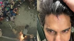 'హిట్ 3' షూటింగ్‌లో నాని తలకు గాయం - ఫుల్ జోష్‌ తో సెట్‌లోకి.. వీడియోస్ చూశారా?