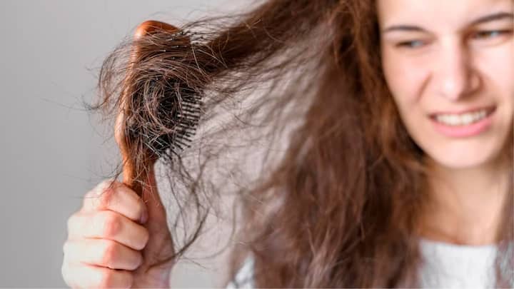 তবে চুল পড়া কমাতে ঘরোয় উপায়ই বেশি কাজে দেবে আপনার। এর জন্য সবার আগে দরকার নারকেল তেল।