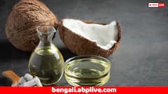 Hair Care: পাতলা হয়ে যাচ্ছে চুল ? চিন্তা কমাবে নারকেল তেল, শুধু এই পাতার রস মিশিয়ে লাগালেই উপকার