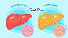 లివర్​లో కొవ్వు పెరిగిపోతే డైట్​లో చేయాల్సిన మార్పులివే.. ఫ్యాటీ లివర్​ ఫ్రెండ్లీ డైట్, వీక్ ప్లాన్ ఇదే