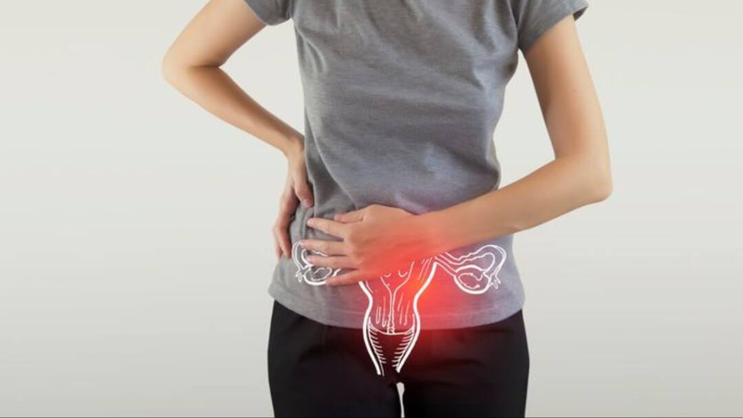 Why Women Dealing With High BMI Can Be At Higher Risk Of Ovarian Cancer Why Women Dealing With High BMI Can Be At Higher Risk Of Ovarian Cancer