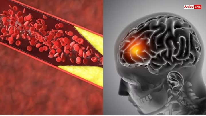 शरीर में बढ़ते कोलेस्ट्रॉल को कम करना बहुत ही जरूरी होता है. अगर आप इसे कम करना चाहते हैं, तो कुछ हेल्दी जूस का सेवन कर सकते हैं. आइए जानते हैं इन जूस के बारे में-