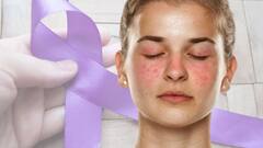 World Lupus Day 2025 — Know Date, History, Significance, And More