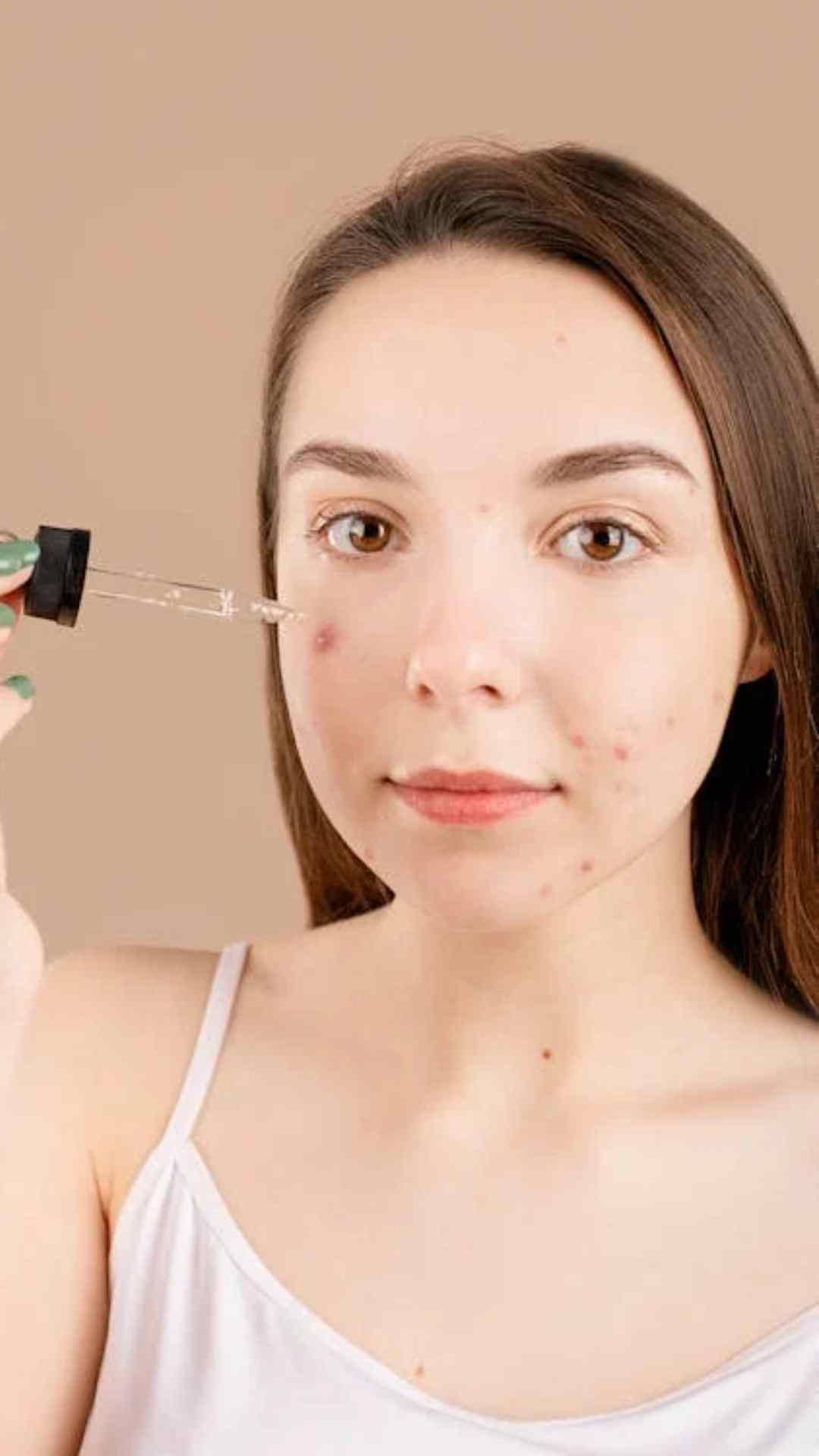 ज्यादातर लोग चेहरे पर पिंपल और फोड़े-फुंसी से छुटकारा पाने के लिए एलोवेरा का यूज करते हैं