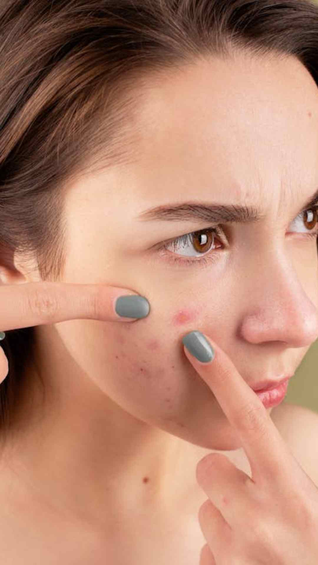 चेहरे से पिंपल्स दूर करने के लिए एलोवेरा को अलग-अलग तरह से इस्तेमाल किया जाता है