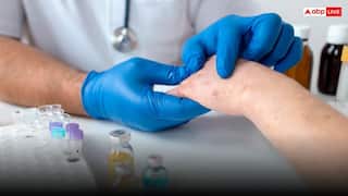 लोहे की चीज से लगने के बाद क्यों लगाना होता है टिटनेस का इंजेक्शन? ये रहा जवाब