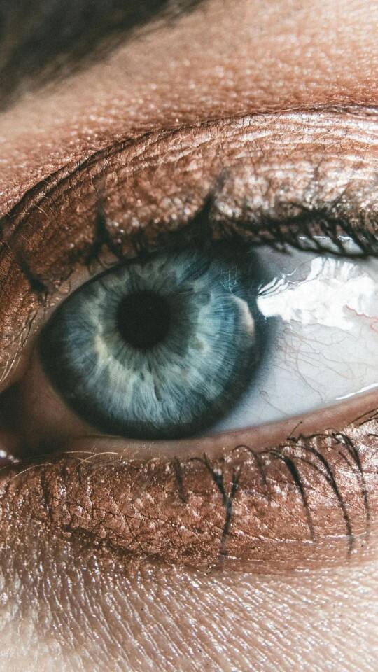 চোখের তলায় সবসময় গাঢ় কালচে ছোপ, সহজে দূর করবেন কীভাবে?