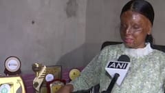 ਹੌਂਸਲੇ ਦੀ ਮਿਸਾਲ ਬਣੀ ਕਾਫੀ, Acid ਅਟੈਕ 'ਚ ਅੰਨੀ ਹੋਈ ਕੁੜੀ ਨੇ ਸਕੂਲ 'ਚ ਕੀਤਾ TOP, ਕਹਾਣੀ ਸੁਣ ਕੇ ਨਹੀਂ ਰੁਕਣਗੇ ਹੰਝੂ