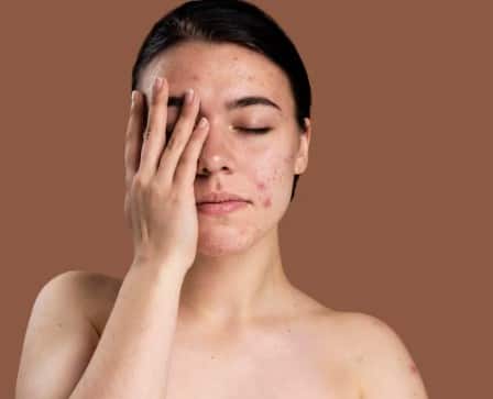 पिंपल वाले लोगों के लिए अखरोट सही नहीं: अगर आपकी बॉडी पहले से ही ‘गर्म’ रहती तो उन्हें अखरोट नहीं खाना चाहिए. इससे सिरदर्द, पिंपल्स या घबराहट जैसी दिक्कतें हो सकती हैं.
