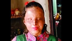 Class 12th Result: கண்கள் போனால் என்ன? கனவு இருக்கிறதே..! 95.6% மதிப்பெண் பெற்ற ஆசிட் வீச்சுக்குள்ளான பிளஸ் 2 மாணவி!