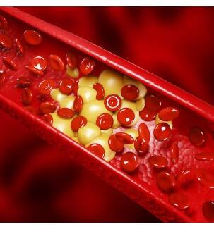 ਜੇ ਤੁਹਾਡੇ ਪੈਰਾਂ ਜਾਂ ਪੈਰ ਦੇ ਅੰਗੂਠੇ 'ਤੇ ਬਣਿਆ ਕੋਈ ਜ਼ਖਮ ਲੰਬੇ ਸਮੇਂ ਤੱਕ ਠੀਕ ਨਹੀਂ ਹੋ ਰਿਹਾ, ਤਾਂ ਇਹ ਇੱਕ ਗੰਭੀਰ ਸੰਕੇਤ ਹੋ ਸਕਦਾ ਹੈ ਜੋ ਕੋਲੈਸਟਰੋਲ ਨਾਲ ਜੁੜਿਆ ਹੋਇਆ ਹੈ। ਖ਼ੂਨ ਦਾ ਸਹੀ ਤਰੀਕੇ ਨਾਲ ਨਾ ਵਹਿਣਾ ਹੀ ਇਸ ਦੀ ਵਜ੍ਹਾ ਹੁੰਦੀ ਹੈ, ਜਿਸ ਕਾਰਨ ਜ਼ਖਮਾਂ ਨੂੰ ਭਰਣ ਵਿੱਚ ਸਮਾਂ ਲੱਗਦਾ ਹੈ।