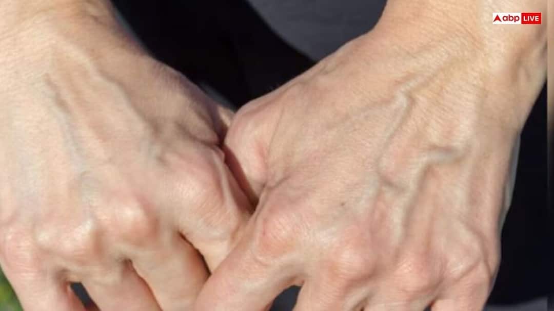 Why do body nerves appear blue Know the interesting science behind it Blue Veins Under Skin:బాడీలోని నరాలు ఎందుకు నీలి రంగులో ఉంటాయి? దాని వెనుక ఉన్న ఆసక్తికరమైన విషయాలేంటీ?